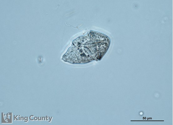 Photo of Gymnodinium rubrum